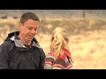 Hair Loss Treatment - Hair Transplant & Baldness