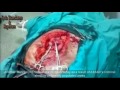 Click here to watch this video Syria, Holeh Another MASSACRE took place in Holeh today as a result of thugs criminal shelling.