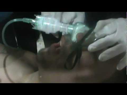 A video shows alleged effects of attack in Al Bayada.