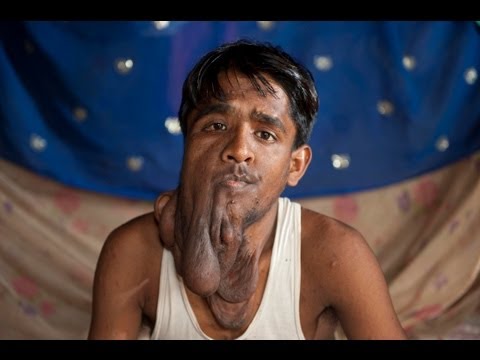 The Elephant Man