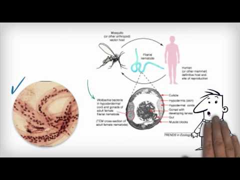 how to treat elephantiasis