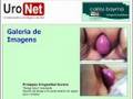 URONET - Urologia - Nº 01