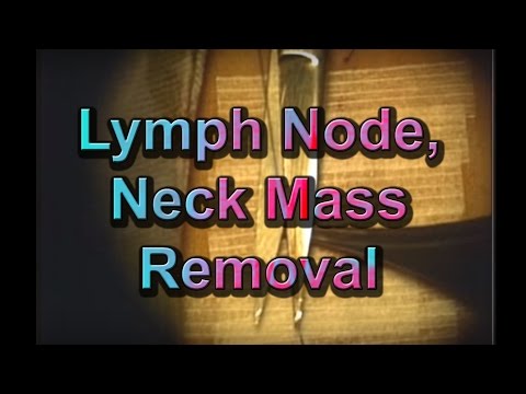 how to drain glands in neck