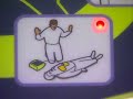 AED defibrillation AED defibrillation