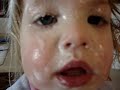 A New Trend in Facial Treatments Facial Treatments