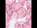 Shotgun Histology Thyroid
