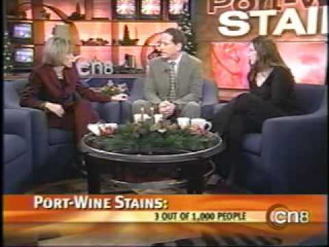 how to treat wine stains