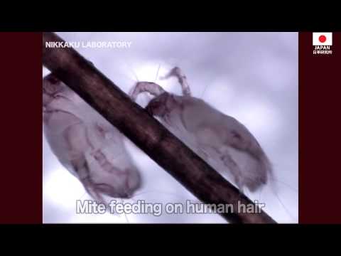 how to control dust mites