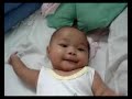 baby kulit