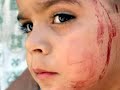 SUFFER the children