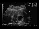 Ultrasound 7 weeks 3 days - TWINS!