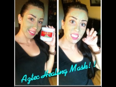Aztec Healing Clay Mask for Acne, Uneven skintone, Blackheads, Whiteheads & more!