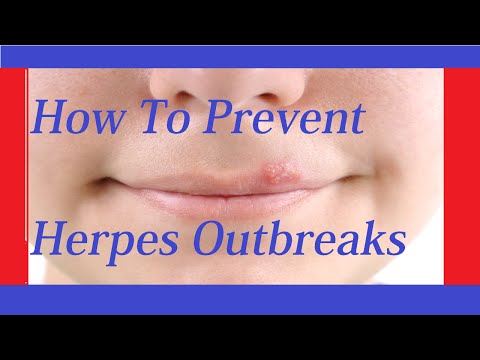 how to relieve genital herpes