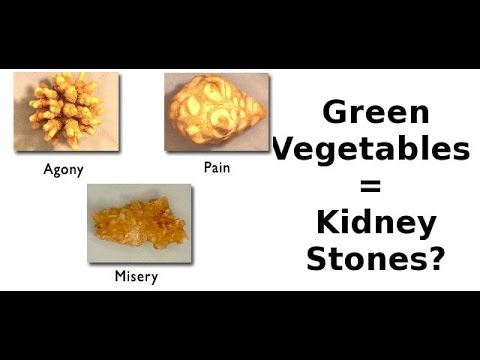 how to dissolve a calcium oxalate kidney stone