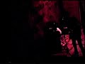 DISPLASIA -UN DIA TRANKILO