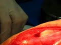 cirugia de tendon cruzado craneal en perro cirugia de tendon cruzado craneal en perro