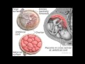 Gestational Diabetes