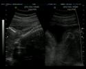 Ultra-sonografia II - Cec�lia