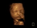 4D Ultrasound Sonogram, Baby in Womb 4D Ultrasound Sonogram, Baby in Womb
