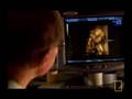 4D Ultrasound Sonogram, Baby in Womb