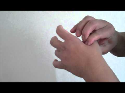 how to relieve wrist and hand pain