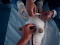 Qx. Colgajo Y en conejo 2/2