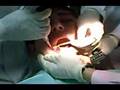 Dentistry Horrors: Wisdom tooth procedure (full)