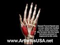 Carpal Tunnel Syndrome by Dr Farshchian