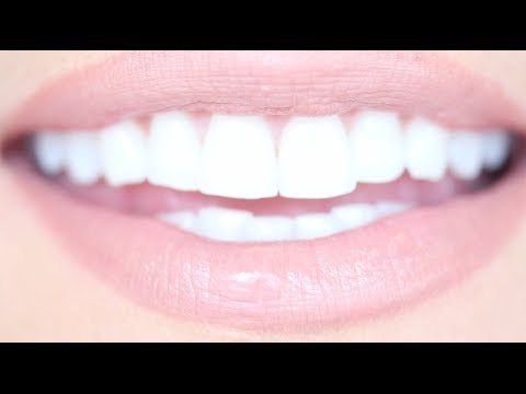 how to i whiten my teeth at home