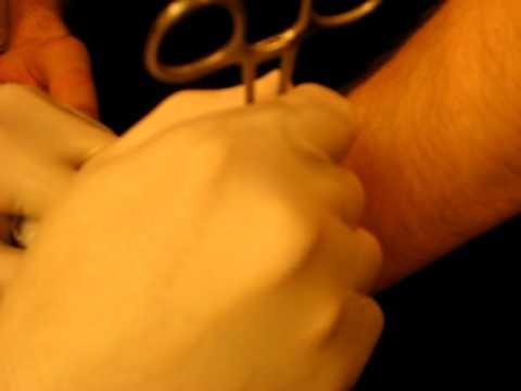 Wrist Microdermal Piercing. Getting micro dermal implant in neck in Tribe 
