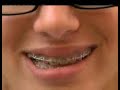 Final patito feo parte 2