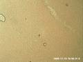 videos de Chameleon Blood Showing Live Microfilariae Parasites Part 3