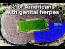 Who Has Herpes? (Sex Health Guru Trivia)