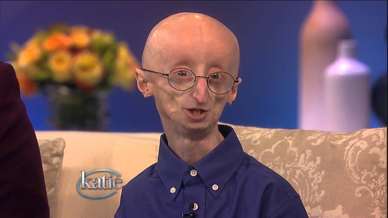 16-year-old with Progeria An Inspiration to All