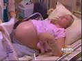 Pregnant with Sextuplets Part 2
