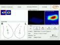 videos de Large Multi-Peaked Mass
