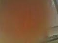 Thumbnail #1