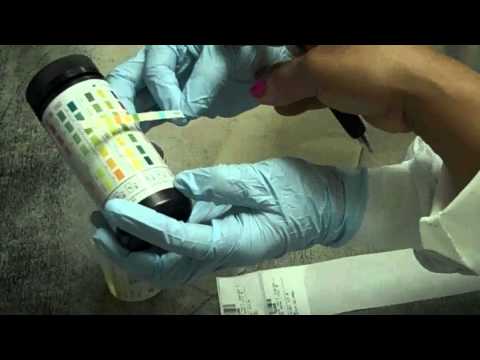 how to read urinalysis