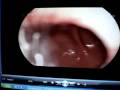 videos de 2