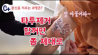 싼 가격따라 아무 피부과에서 타투제거 했더니..