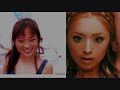 japan plastic surgery trouble  日本整形トラブル 
