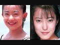 japan plastic surgery trouble  日本整形トラブル 
