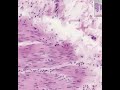 Shotgun Histology Gastric Fundus