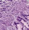 Shotgun Histology Gastric Fundus