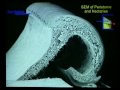 The ICPS World Conference in Tokyo 2002 - Part 14