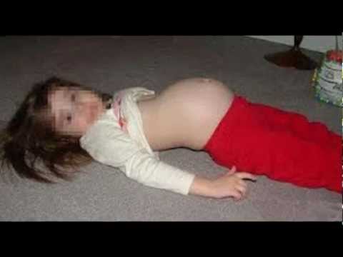 child gyn