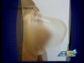 Brava Breast Non-Surgical Enhancement News Story Brava Breast Non-Surgical Enhancement News Story