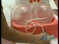 Brava Breast Non-Surgical Enhancement News Story