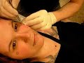 microdermal on missdy microdermal on missdy