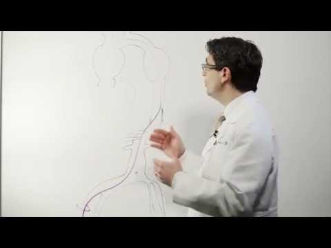 how to treat aortic aneurysm